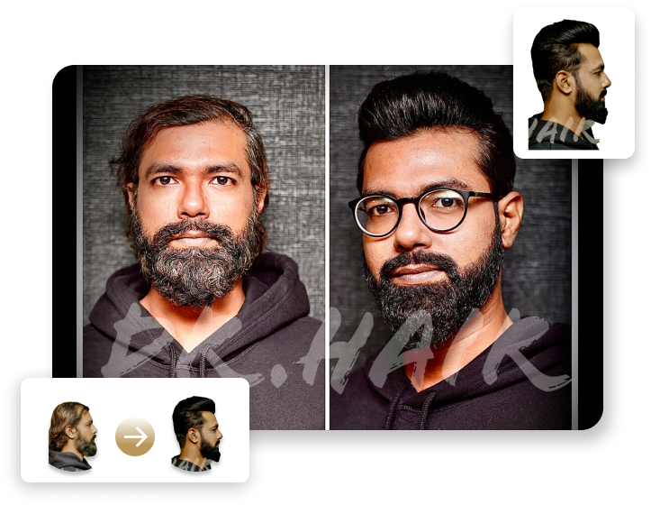 Hair replacement in Chennai | Tamilnadu | Non surgical hair bonding | Hair  fixing