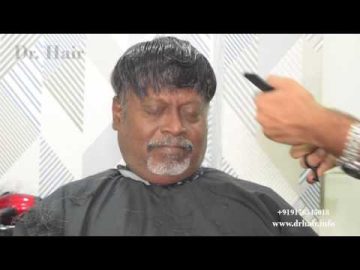 Hair replacement in Chennai | Hair wig | Non surgical hair bonding | Hair fixing | Hair patch